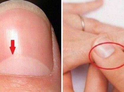 Tudod, hogy mit jelez a körömhold?