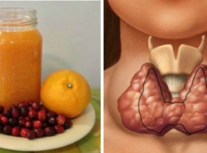 Állítsd össze ezt a keveréket: lefogysz, elindítja a pajzsmirigyed, és eltüntet minden gyulladást a testedből