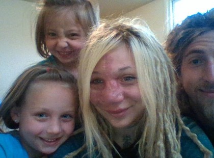 Az orvosok levágták az orrát, hogy megmentsék az életét. Mosolyogni fogsz, amikor látod, hogy néz ki most.