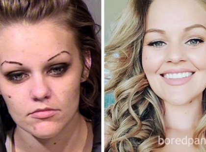 20 előtte és utána kép azokról az emberekről, akik abbahagyták a drogozást – a 13-as számú hihetetlen