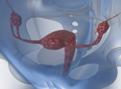 Ezeket a dolgokat semmiképp ne tedd a menstruáció ideje alatt, mert akár halálos kimenetelű is lehet!