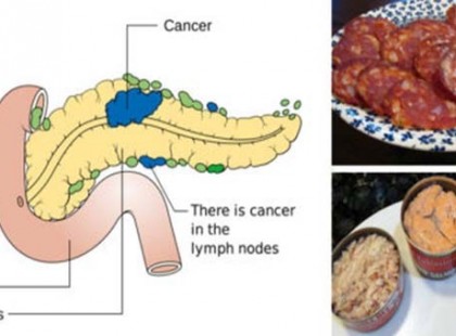 14 rákkeltő étel, amit soha többé nem szabadna a szádba venned!