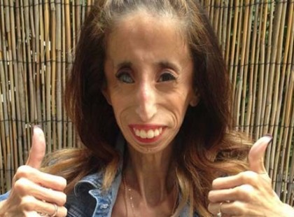 A világ legrondább nőjének csúfolták, de váratlan fordulat következett be életében!