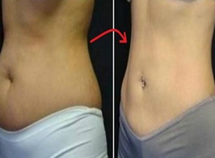 14 napos kihívás, ami az összes felesleget leszedi rólad és a méreganyagoktól is megszabadít!