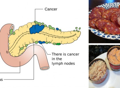 14 rákkeltő étel, amit soha többé nem szabadna a szádba venned!