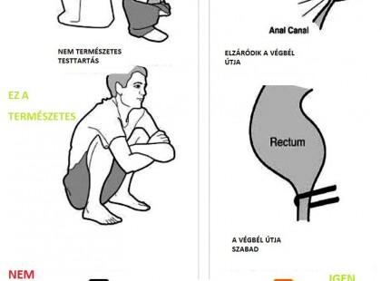 Kiderült, miért van egyre több embernek szorulása, a megoldás sokak egészségét mentheti meg