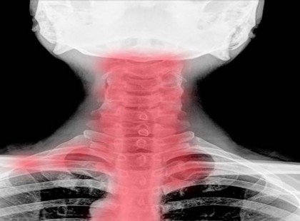 Szédülni szoktál? Zsibbadnak a végtagjaid? Nagyon rossz hírünk van!