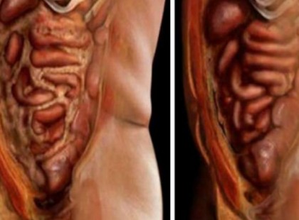 Meg akarsz szabadulni a parazitáktól és a felesleges hájtól? Egyetlen csipetnyi ebből a két hétköznapi összetevőből segít!