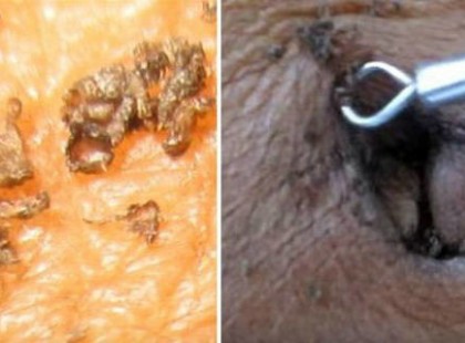 Ezek a tested legkoszosabb, veszélyesebb részei, a 7.-en megdöbbentem