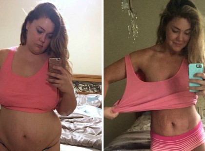 A HÖLGY 141 KG VOLT, EGY ÉV MÚLVA CSAK 57 KG. ÍME A SIKER TITKA!