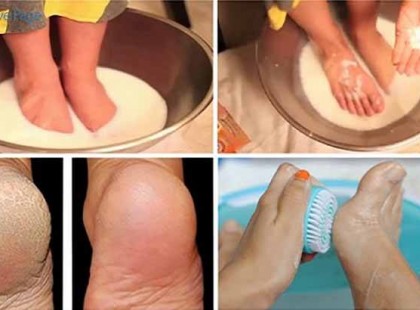 Soha többet nem költesz pedikűrre, ha ezt elolvasod!