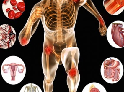 Itt a teljes lista: ha itt vagy beteg, ez a lelki gond áll a háttérben! Mentsd el magadnak!