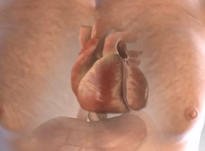 Ez az 5 tünet egy hónappal előre jelzi a szívinfarktust. Figyelj oda rájuk, az életedet mentheti meg!