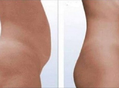 Búcsút mondhatsz a hasi zsíroknak, mindössze 2 hétig használd ezt a házi receptet