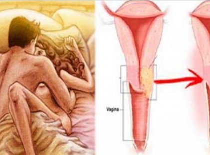 Ha több mint 7 napig nem létesítesz “romantikus” kapcsolatot ilyen betegségeknek teszed ki a szervezeted