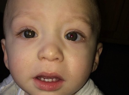 Az apa lefényképezi egyéves kisfiát – félelmetes dolgot fedez fel amikor a szemére közelít a géppel