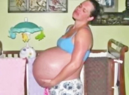 Ami ennek a nőnek a hasában volt, még az orvosokat is sokkolta. Senki sem számított erre.