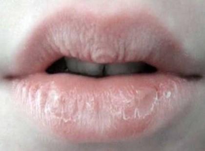 Jelek, amelyeket a testünk küld, hogy nem vagyunk egészségesek