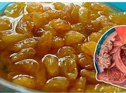 Létezik egy gyümölcs ami jó a vastagbél,- máj és prosztatarák kezelésére. Ezt a különleges gyümölcsöt fogyassza naponta!