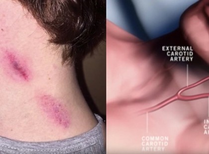 Vacsora közben elkezdett remegni, majd percekkel később meghalt. Az orvosok diagnózisa mindenkit sokkolt!