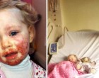 A kislány véres arccal szalad oda anyjához – el sem hiszi mikor rájön, mi történt