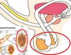 Jó ha tudod, hogy 10-ből 9 férfi potenciazavarát ezek okozhatják – De van megoldás!