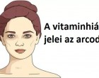 5 jelzés az arcodon, amely azt mutatja, hogy vitaminhiányod van