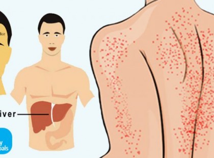 Ezzel a 15 jellel sikít a májad, hogy nagy a baj! Ne károsítsd tovább