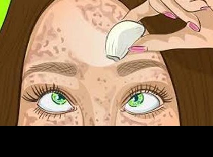 Fedezd fel az ősi gyógyszert, ami eltüntet minden foltot az arcodról, és amellyel olyan lesz a bőröd, amilyenre mindig vágytál