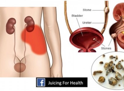 Sokszor kell éjjel pisilned menni? Ezt kell tenned, hogy elmúljon