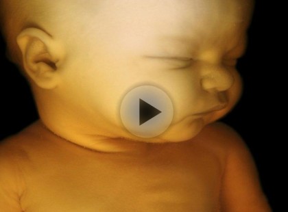 Ezt csinálják unalmukban a kisbabák az anyaméhben… (egyedi felvételek)!