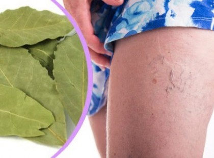 Ez az egyszerű levél megszabadíthat a visszerektől, a memória zavartól és a fejfájástól is! Csak akkor hat, ha így készíted el!