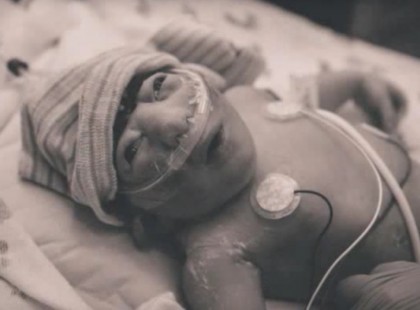 A szülők gyönyörködnek a magzatban az ultrahang felvételen de a nővér valami szörnyűt mond