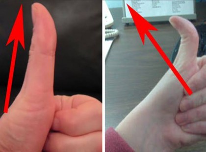 Neked milyen a hüvelykujjad: merev vagy hajlékony? Ezt árulja el rólad!