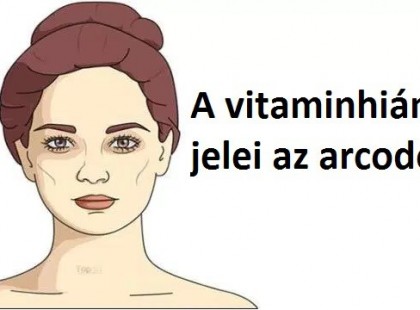 5 jelzés az arcodon, amely azt mutatja, hogy vitaminhiányod van