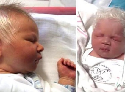 A baba fehér hajjal született, de amikor az orvosok kiderítették az okot, a szülők nem …