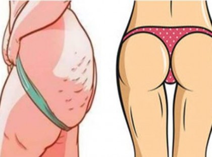 Ez a hormon megakadályozza, hogy le tudj fogyni. Eláruljuk hogy “kapcsold ki”!