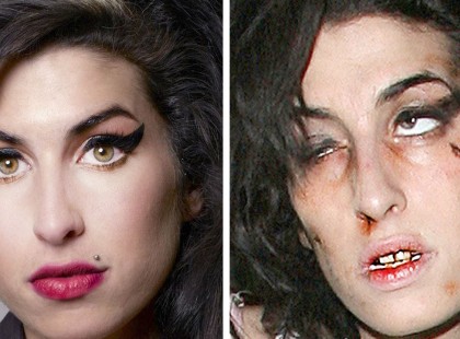 Így néznek ki napjainkban az a 10 híres kábítószerfüggő celeb akik olykor a világ királyai voltak