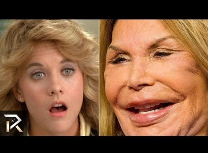 Nagyon híres emberek, akik mára felismerhetetlené plasztikáztak magukat