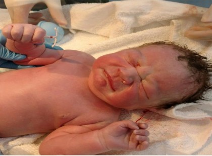 A baba, aki egy fogamzásgátló spirállal a kezében látta meg a napvilágot – Mert az Élet, élni akar