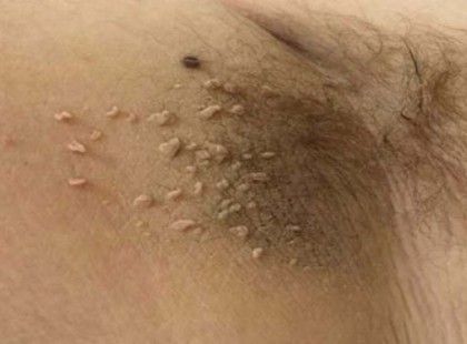 Mindenkinek van, de senki nem tudja eltávolítani könnyen. EZ A TRÜKK EGY CSODA A SZEMÖLCSÖK ELLEN…