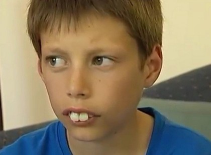 Osztálytársai nyúlfogúnak hívták… de 5 évvel később Rá sem ismertek!