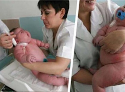 A nő 18 kg súlyú gyermeket szült – a világon a legnagyobbat