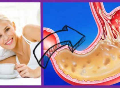 7 étel és ital, amit soha ne fogyassz éhgyomorra! A 2. és az 5. különösen meglepő..