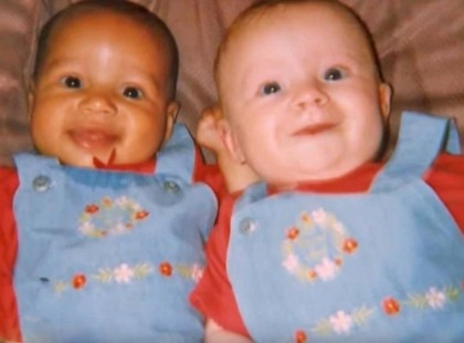 Egy anya két különböző színű ikernek adott életet. Nézd meg hogy néznek ki most, 18 évvel később!