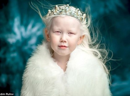 Amikor ez a kislány megszületett, szülei le voltak nyűgözve… de azóta már 8 év telt el…