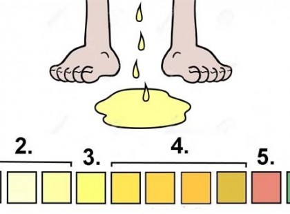 A vizeleted színe ezekről a betegségekről árulkodik?