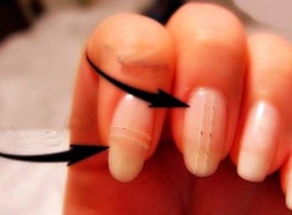 10 betegség, amire valamelyik szervünk hívja fel a figyelmet!