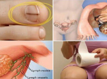 20 JELZÉS, hogy halálos kór van a szervezetedben, amit a legtöbb nő elhanyagol