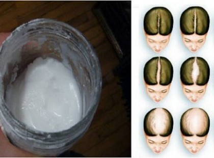 Szódabikarbóna sampon: úgy nő majd a hajad, mintha húznák